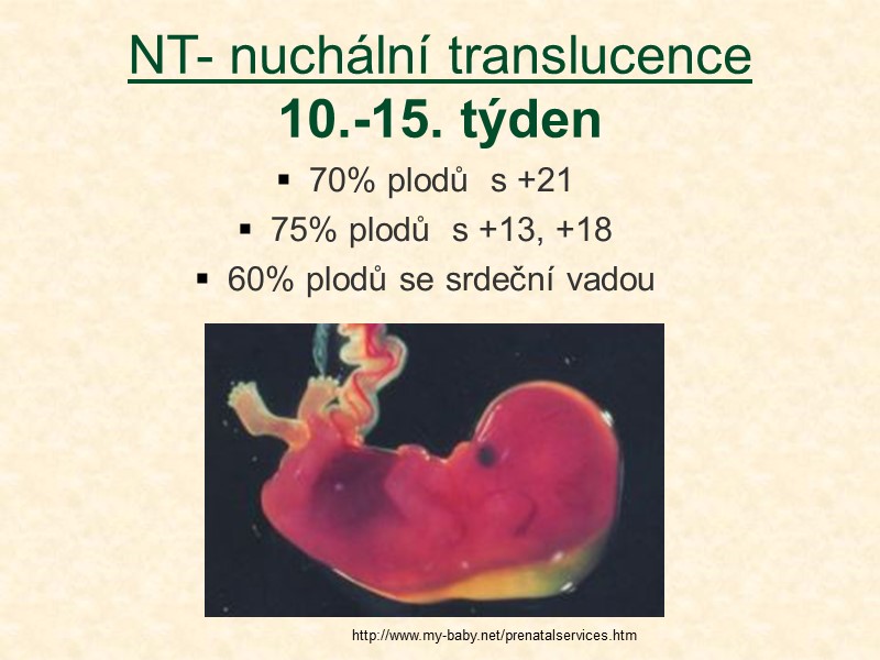 NT- nuchální translucence 10.-15. týden 70% plodů  s +21 75% plodů  s